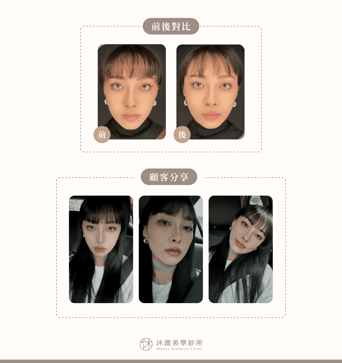 案例 1：豐潤自然唇型