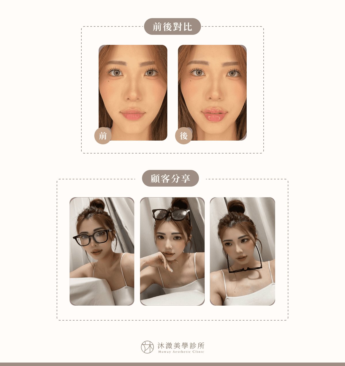 案例 2：性感魅力嘟嘟唇