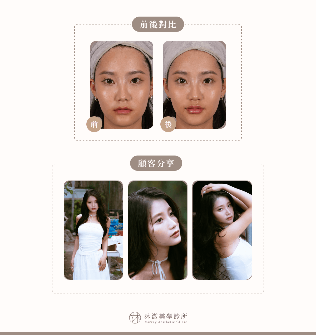 案例 5：唇薄與唇紋改善