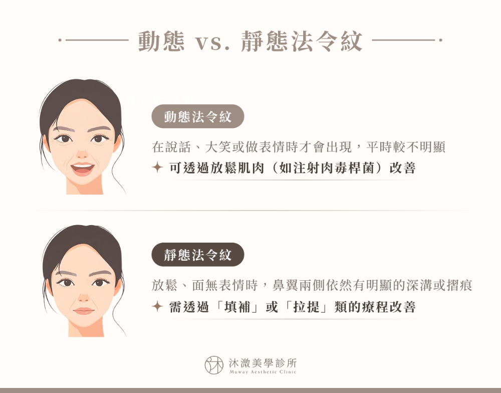 動態 vs. 靜態法令紋