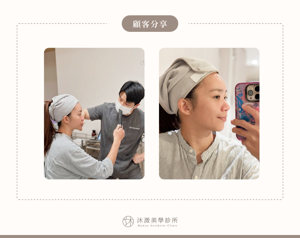 沐溦美學診所案例 1：「無濾鏡」自然緊緻美肌