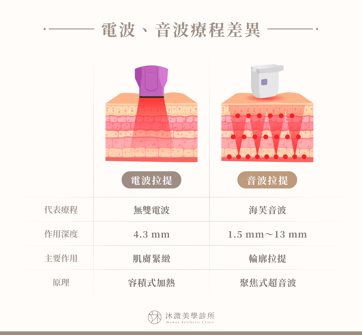 電波容積式加熱與音波聚焦式加熱作用深度差異示意圖