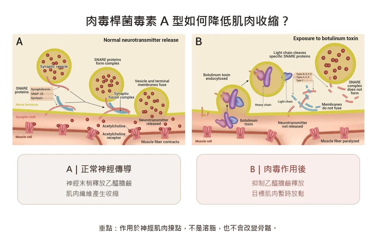 肉毒桿菌毒素抑制乙醯膽鹼釋放,使目標肌肉暫時放鬆的中英文作用原理圖