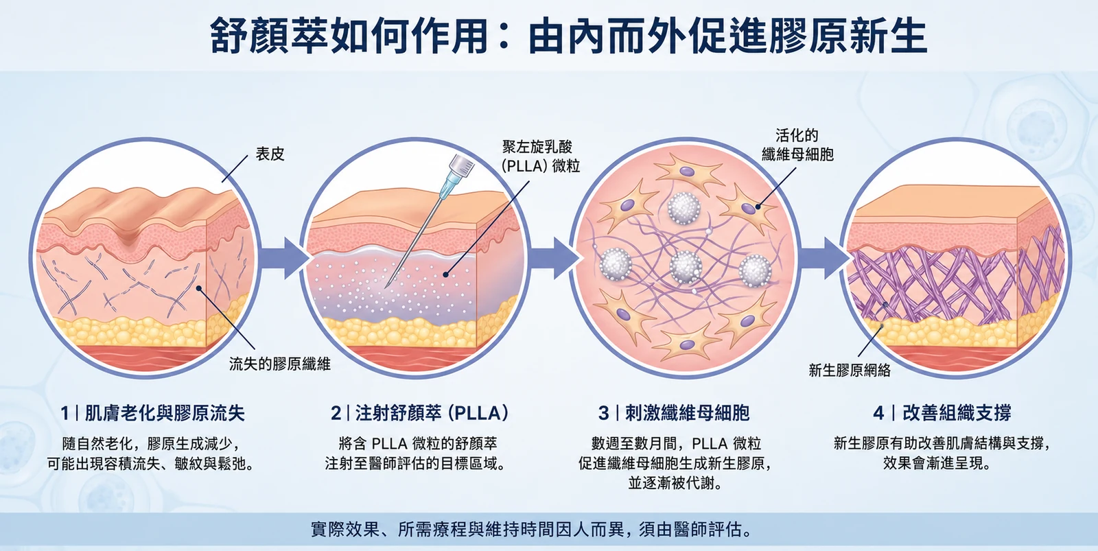 舒顏萃PLLA刺激纖維母細胞與膠原新生作用原理