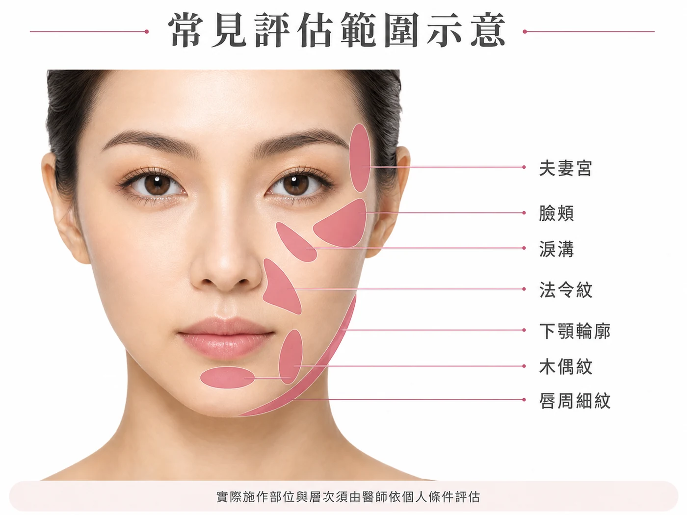 舒顏萃常見臉部評估範圍示意