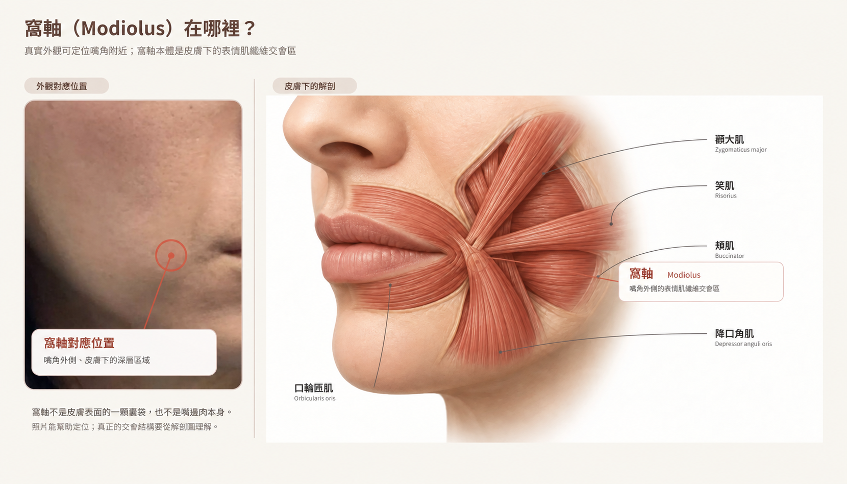 真實人臉與解剖圖對照窩軸Modiolus位置