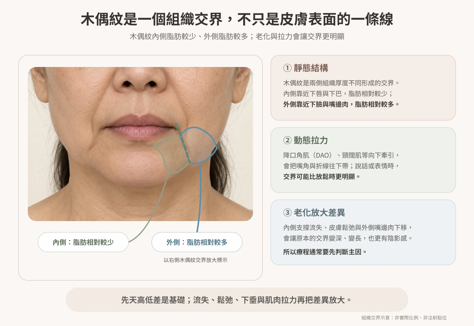 木偶紋外側脂肪較多、內側脂肪較少的組織交界示意