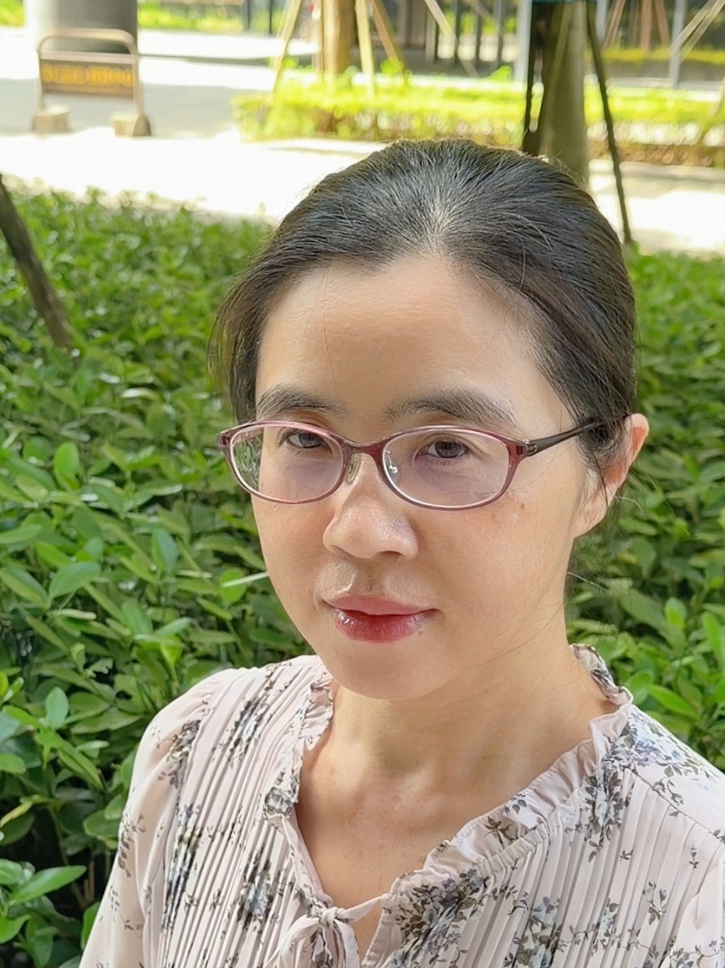 沐溦美學診所案例分享－脫掉口罩自信展露笑顏｜玻尿酸嘟嘟唇｜素人張媽媽